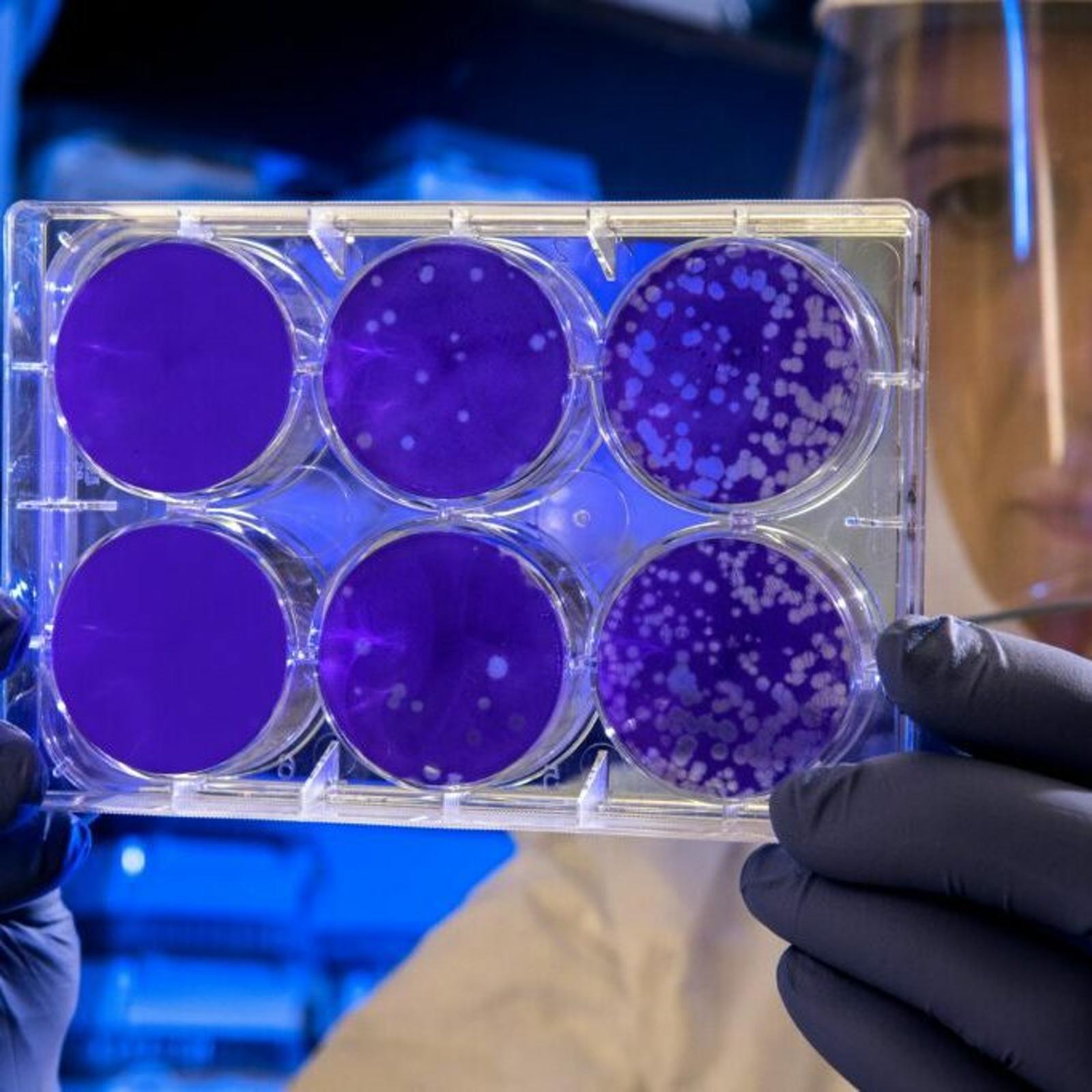 person-holding-petri-dishes-1024x683-square.jpg