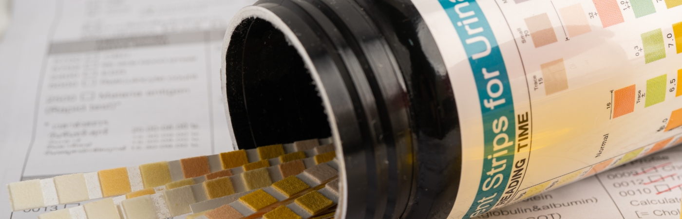 OEM Pumps for Automated Urinalysis Analyzers
