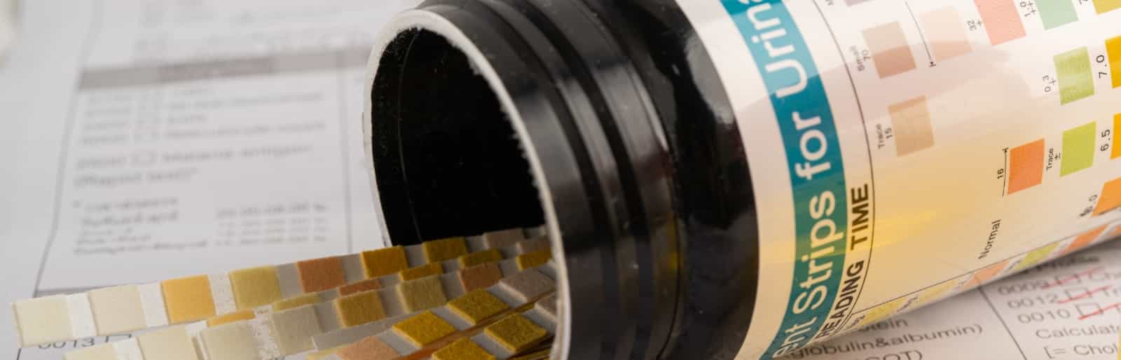 OEM Pumps for Automated Urinalysis Analyzers