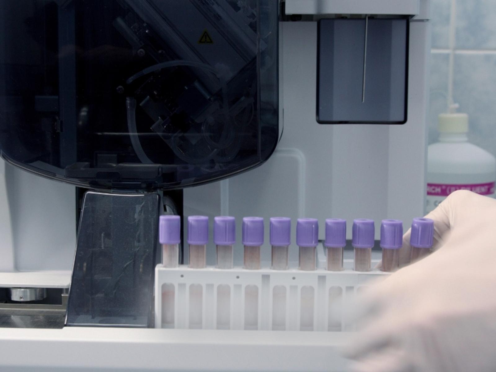 Thomas_Blood Gas Analyzer Pumps_Card.jpg