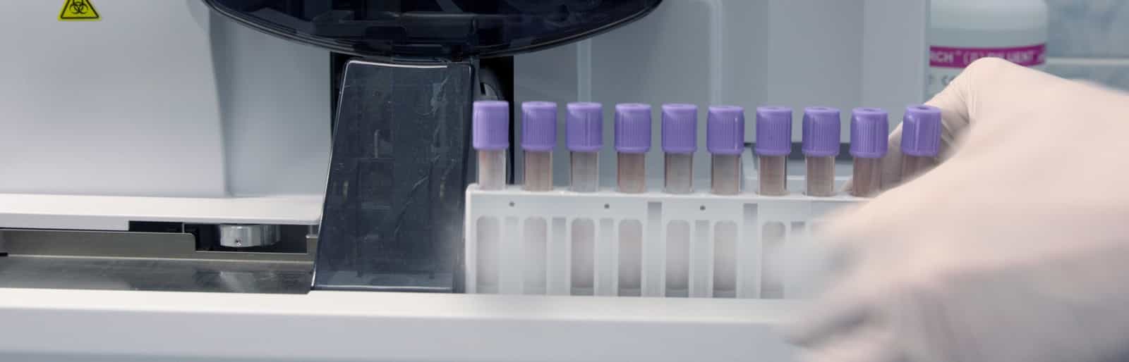 Blood Gas Analyzer Pumps