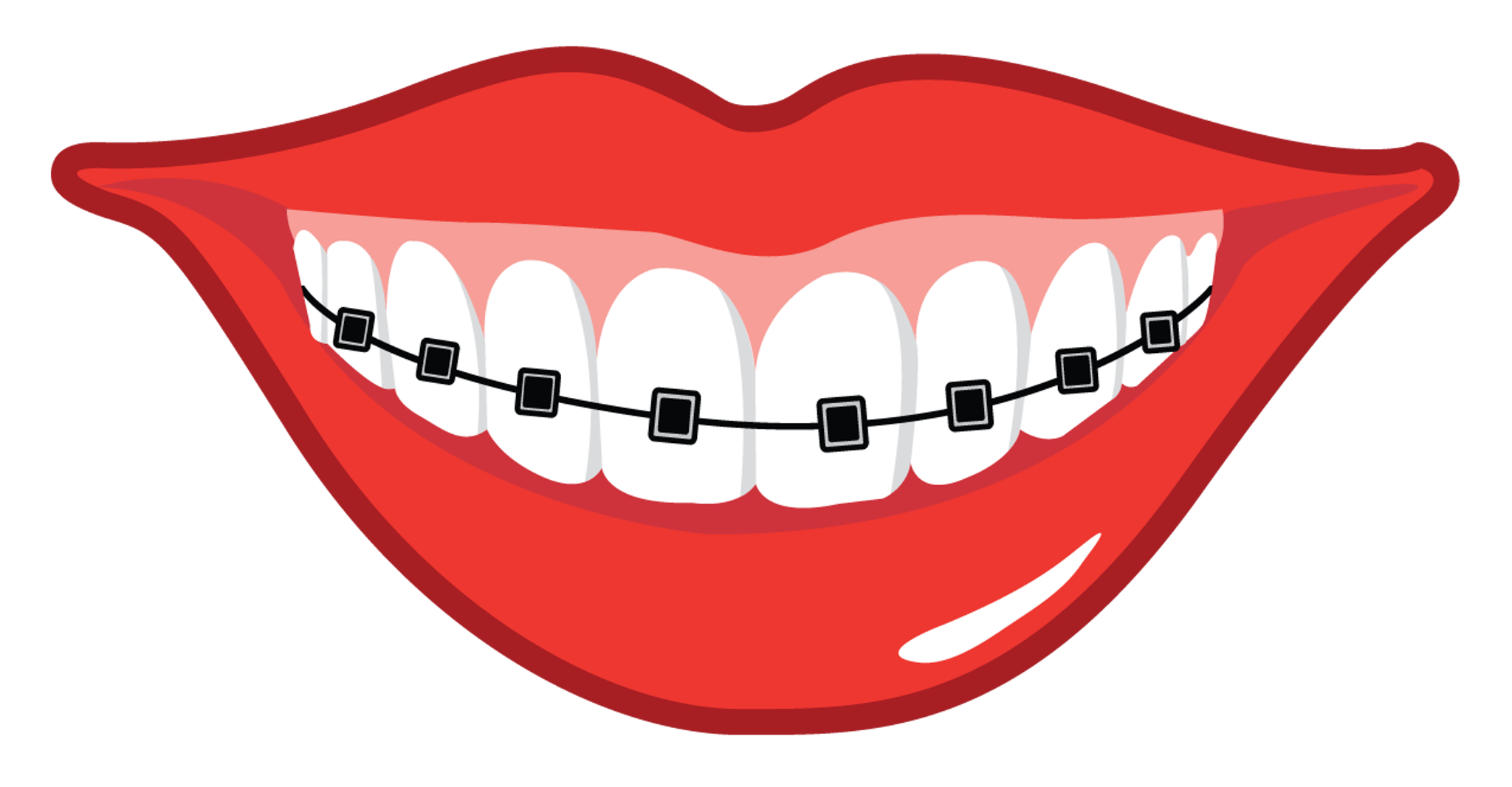 braces