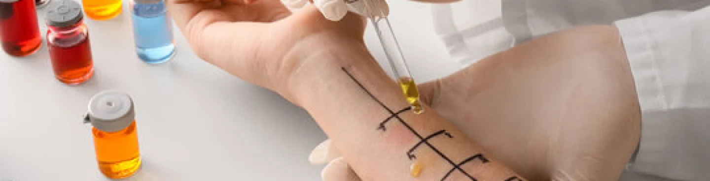 Allergy_testing_Hero_Banner.webp