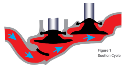 PVP - Suction Cycle